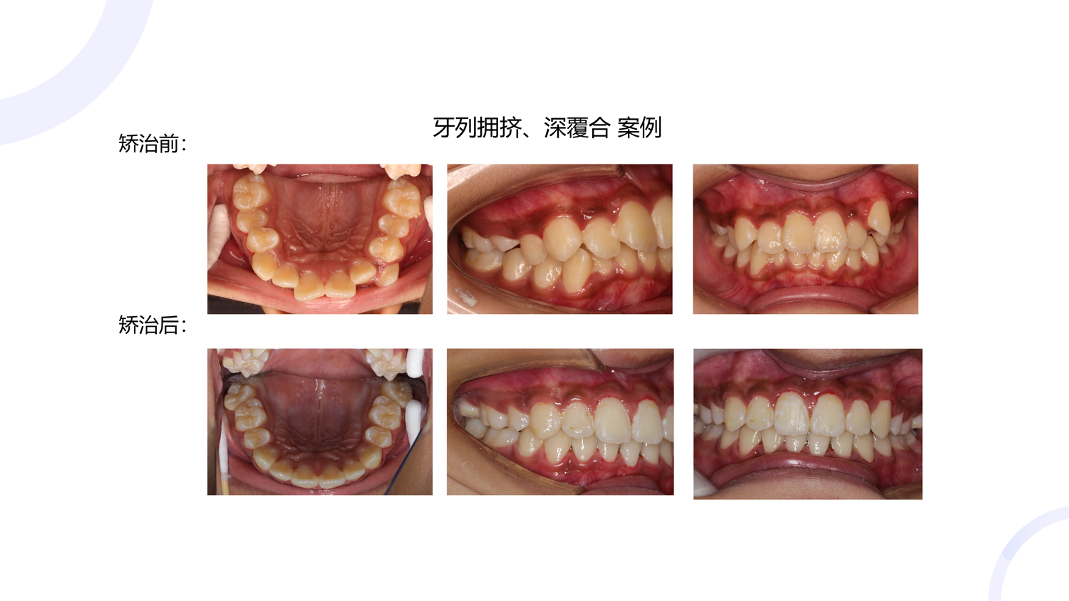 案例三