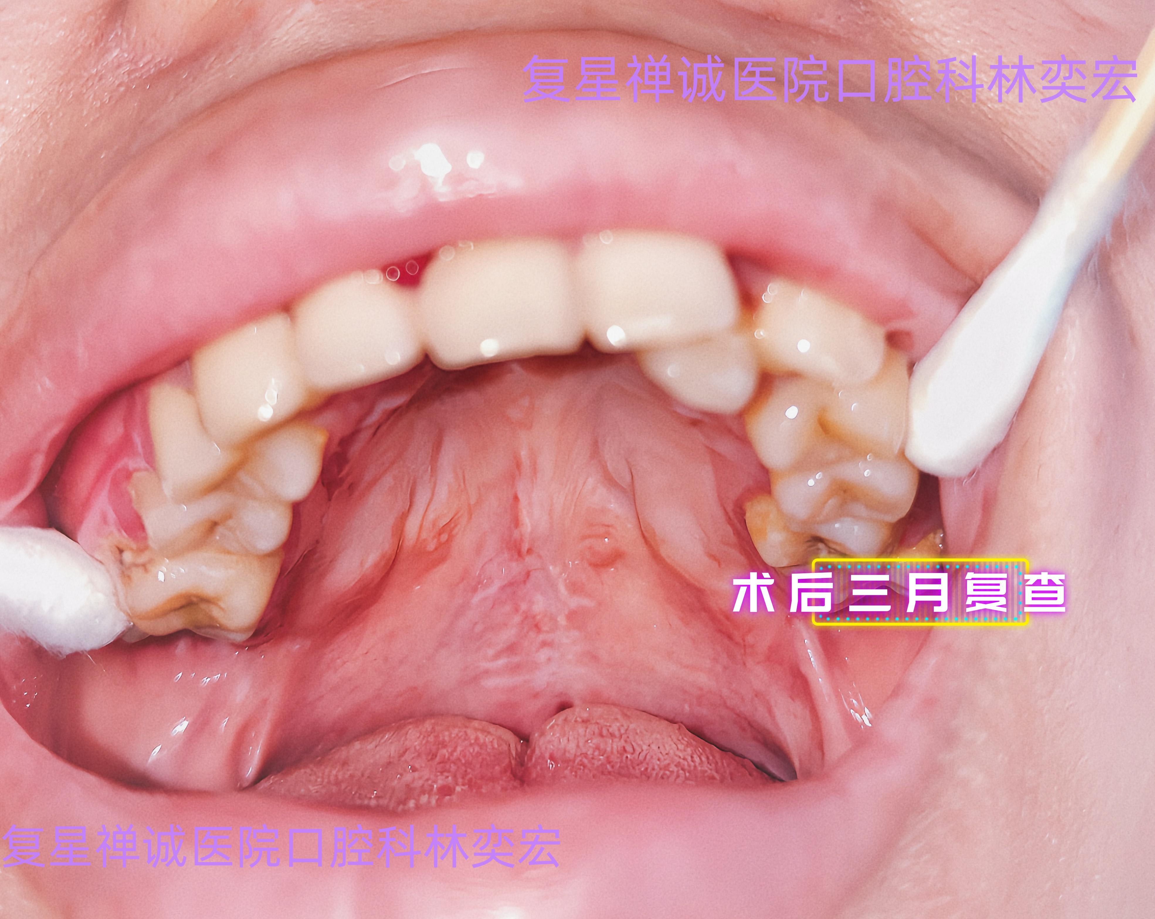 种植过程