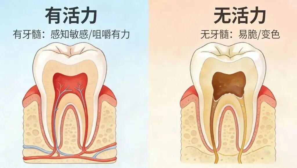 微创全牙髓保存技术