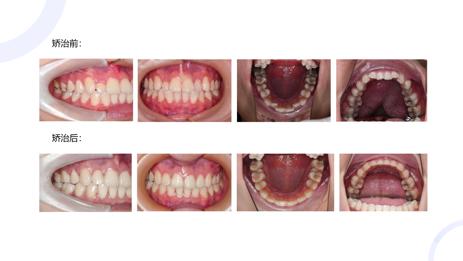 案例四