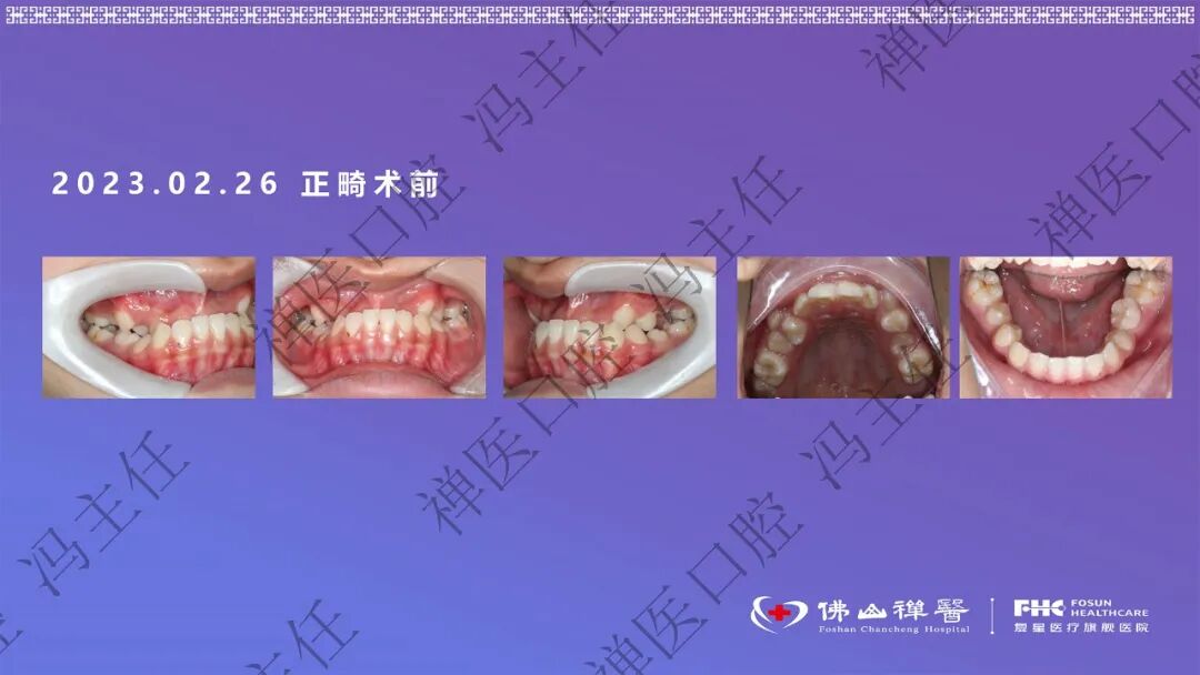 口内检查与方案沟通