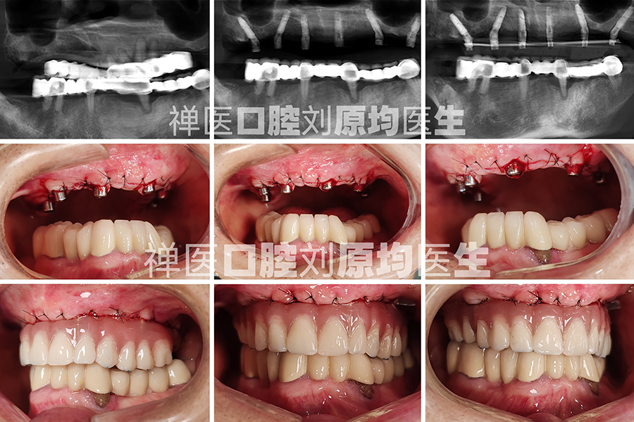 种植案例